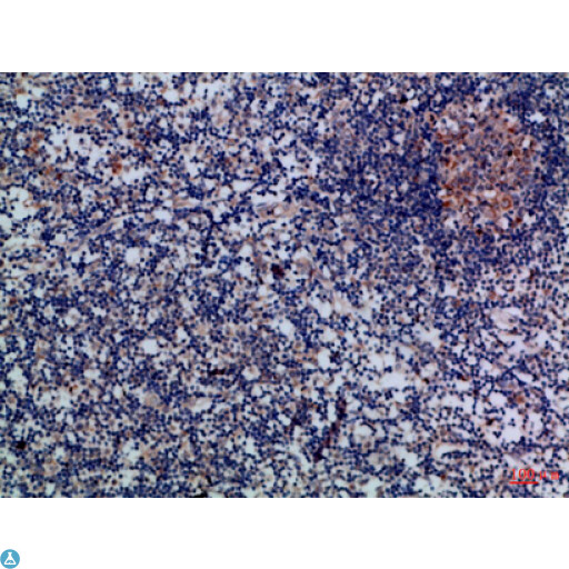 GZMM / Granzyme M Antibody - Immunohistochemical analysis of paraffin-embedded Human-lymph, antibody was diluted at 1:100.