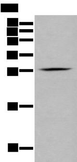 GZMM / Granzyme M Antibody - Western blot analysis of RAW264.7 cell  using GZMM Polyclonal Antibody at dilution of 1:400