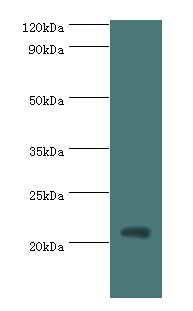 H1F0 Antibody - Western blot. All lanes: Histone H1.0 antibody at 3 ug/ml+Jurkat whole cell lysate. Secondary antibody: Goat polyclonal to rabbit at 1:10000 dilution. Predicted band size: 21 kDa. Observed band size: 21 kDa Immunohistochemistry.