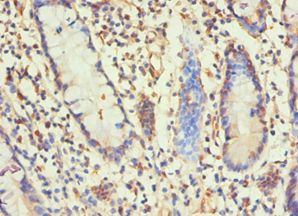 H1F0 Antibody - Immunohistochemistry of paraffin-embedded human small intestine using antibody at 1:100 dilution.