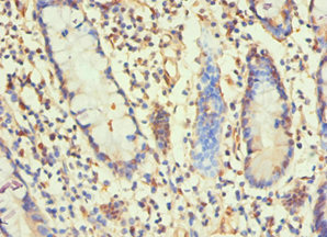 H1F0 Antibody - Immunohistochemistry of paraffin-embedded human small intestine tissue using H1F0 Antibody at dilution of 1:100