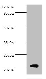 H1F0 Antibody - Western blot All lanes: Histone H1.0 antibody at 3µg/ml + Jurkat whole cell lysate Secondary Goat polyclonal to rabbit IgG at 1/10000 dilution Predicted band size: 21, 20 kDa Observed band size: 21 kDa