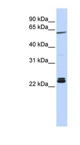 H1F0 Antibody - Histone H1 antibody Western blot of HeLa lysate. This image was taken for the unconjugated form of this product. Other forms have not been tested.