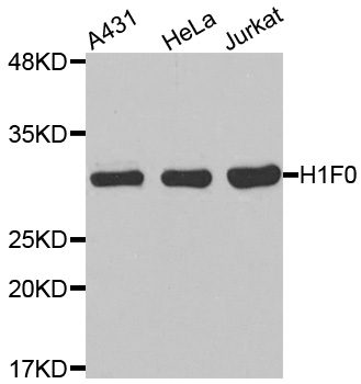 H1F0 Antibody - Western blot analysis of extracts of various cell lines.