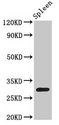 H1F0 Antibody - Positive Western Blot detected in Rat spleen tissue. All lanes: H1F0 antibody at 1.5 µg/ml Secondary Goat polyclonal to rabbit IgG at 1/50000 dilution. Predicted band size: 32 KDa. Observed band size: 32 KDa