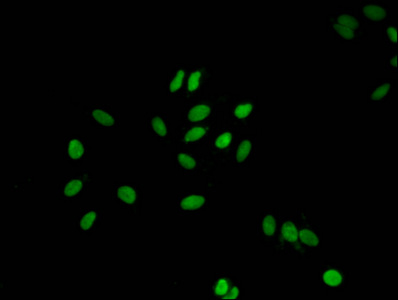 H1F0 Antibody - Immunofluorescent analysis of Hela cells at a dilution of 1:100 and Alexa Fluor 488-congugated AffiniPure Goat Anti-Rabbit IgG(H+L)