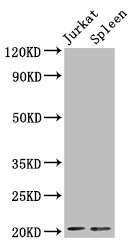 H1F0 Antibody - Positive Western Blot detected in Jurkat whole cell lysate, Rat spleen tissue. All lanes: H1F0 antibody at 1.5 µg/ml Secondary Goat polyclonal to rabbit IgG at 1/50000 dilution. Predicted band size: 21, 20 KDa. Observed band size: 21 KDa