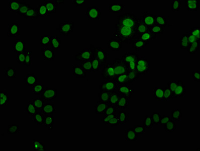 H1F0 Antibody - Immunofluorescence staining of hepg2 with DAPI. The cells were fixed in 4% formaldehyde, permeabilized using 0.2% Triton X-100 and blocked in 10% normal Goat Serum. The cells were then incubated with the antibody overnight at 4 °C.The secondary antibody was Alexa Fluor 488-congugated AffiniPure Goat Anti-Rabbit IgG (H+L) .