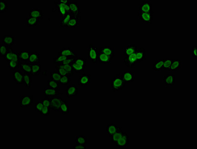 H1F0 Antibody - Immunofluorescence staining of hepg2 with DAPI. The cells were fixed in 4% formaldehyde, permeabilized using 0.2% Triton X-100 and blocked in 10% normal Goat Serum. The cells were then incubated with the antibody overnight at 4 °C.The secondary antibody was Alexa Fluor 488-congugated AffiniPure Goat Anti-Rabbit IgG (H+L) .