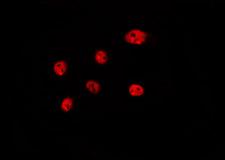 H1F0 Antibody - Staining HeLa cells by IF/ICC. The samples were fixed with PFA and permeabilized in 0.1% Triton X-100, then blocked in 10% serum for 45 min at 25°C. The primary antibody was diluted at 1:200 and incubated with the sample for 1 hour at 37°C. An Alexa Fluor 594 conjugated goat anti-rabbit IgG (H+L) Ab, diluted at 1/600, was used as the secondary antibody.