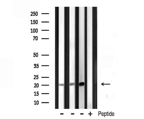 H1F0 Antibody - Western blot analysis of Histone 1F0 expression in various lysates