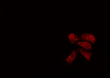 H1F0 Antibody - Staining A549 cells by IF/ICC. The samples were fixed with PFA and permeabilized in 0.1% Triton X-100, then blocked in 10% serum for 45 min at 25°C. The primary antibody was diluted at 1:200 and incubated with the sample for 1 hour at 37°C. An Alexa Fluor 594 conjugated goat anti-rabbit IgG (H+L) antibody, diluted at 1/600, was used as secondary antibody.