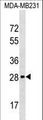 H1FOO Antibody - H1FOO Antibody western blot of MDA-MB231 cell line lysates (35 ug/lane). The H1FOO antibody detected the H1FOO protein (arrow).