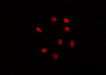 H1FOO Antibody - Staining HepG2 cells by IF/ICC. The samples were fixed with PFA and permeabilized in 0.1% Triton X-100, then blocked in 10% serum for 45 min at 25°C. The primary antibody was diluted at 1:200 and incubated with the sample for 1 hour at 37°C. An Alexa Fluor 594 conjugated goat anti-rabbit IgG (H+L) Ab, diluted at 1/600, was used as the secondary antibody.