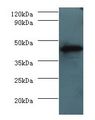 H2-D1 Antibody - western blot All lanes: H-2 class I histocompatibility antigen, D-D alpha chain antibody at 2 ug/ml+mouse spleen tissue. Secondary antibody: Goat polyclonal to rabbit at 1:10000 dilution. Predicted band size: 41 kDa. Observed band size: 41 kDa.  This image was taken for the unconjugated form of this product. Other forms have not been tested.