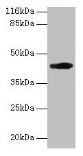 H2-D1 Antibody - Western blot All lanes: H2-D1 antibody at 2µg/ml + A549 whole cell lysate Secondary Goat polyclonal to rabbit IgG at 1/10000 dilution Predicted band size: 41 kDa Observed band size: 41 kDa