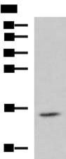 H2AFJ Antibody - Western blot analysis of Jurkat cell lysate  using H2AFJ Polyclonal Antibody at dilution of 1:800