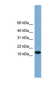 H2AFX / H2AX Antibody - H2AFX / H2AX antibody Western blot of NCI-H226 cell lysate. This image was taken for the unconjugated form of this product. Other forms have not been tested.