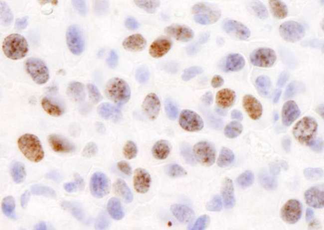 H2AFX / H2AX Antibody - Detection of Mouse H2AX by Immunohistochemistry. Sample: FFPE section of mouse squamous cell carcinoma. Antibody: Affinity purified rabbit anti-H2AX used at a dilution of 1:500. Detection: DAB.