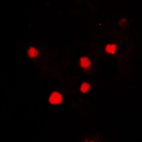 H2AFX / H2AX Antibody - Immunofluorescent analysis of Histone H2A.X staining in MCF7 cells. Formalin-fixed cells were permeabilized with 0.1% Triton X-100 in TBS for 5-10 minutes and blocked with 3% BSA-PBS for 30 minutes at room temperature. Cells were probed with the primary antibody in 3% BSA-PBS and incubated overnight at 4 C in a humidified chamber. Cells were washed with PBST and incubated with a DyLight 594-conjugated secondary antibody (red) in PBS at room temperature in the dark. DAPI was used to stain the cell nuclei (blue).