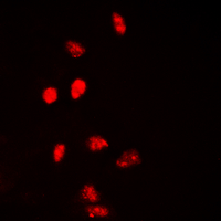 H2AFX / H2AX Antibody - Immunofluorescent analysis of Histone H2A.X staining in HepG2 cells. Formalin-fixed cells were permeabilized with 0.1% Triton X-100 in TBS for 5-10 minutes and blocked with 3% BSA-PBS for 30 minutes at room temperature. Cells were probed with the primary antibody in 3% BSA-PBS and incubated overnight at 4 deg C in a humidified chamber. Cells were washed with PBST and incubated with a DyLight 594-conjugated secondary antibody (red) in PBS at room temperature in the dark. DAPI was used to stain the cell nuclei (blue).