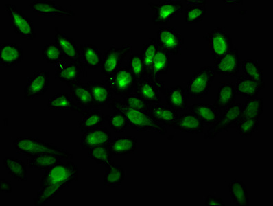 H2AFX / H2AX Antibody - Immunofluorescence staining of hela with DAPI. The cells were fixed in 4% formaldehyde, permeabilized using 0.2% Triton X-100 and blocked in 10% normal Goat Serum. The cells were then incubated with the antibody overnight at 4°C.The secondary antibody was Alexa Fluor 488-congugated AffiniPure Goat Anti-Rabbit IgG (H+L) .