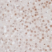 H2AFX / H2AX Antibody - Immunohistochemistry of paraffin-embedded rat liver using H2AFX antibody at dilution of 1:100 (40x lens).