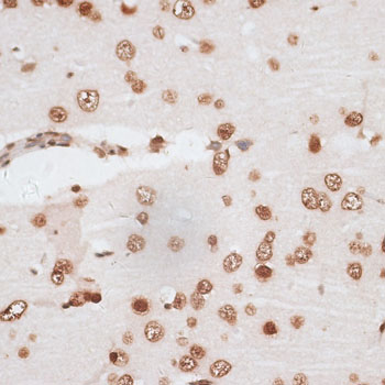 H2AFX / H2AX Antibody - Immunohistochemistry of paraffin-embedded rat brain using H2AFX antibody at dilution of 1:100 (40x lens).