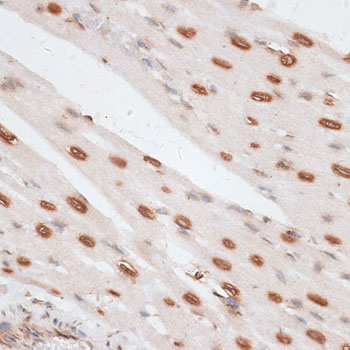 H2AFX / H2AX Antibody - Immunohistochemistry of paraffin-embedded rat heart using H2AFX antibody at dilution of 1:100 (40x lens).
