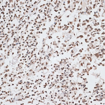 H2AFX / H2AX Antibody - Immunohistochemistry of paraffin-embedded human tonsil using H2AFX antibody at dilution of 1:100 (40x lens).