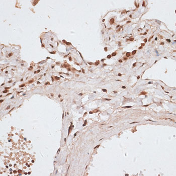 H2AFX / H2AX Antibody - Immunohistochemistry of paraffin-embedded human lung using H2AFX antibody at dilution of 1:100 (40x lens).