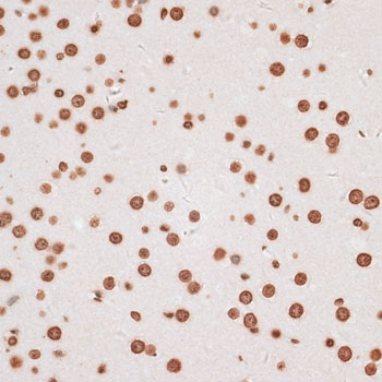 H2AFX / H2AX Antibody - Immunohistochemistry of paraffin-embedded mouse brain using H2AFX antibody at dilution of 1:100 (40x lens).