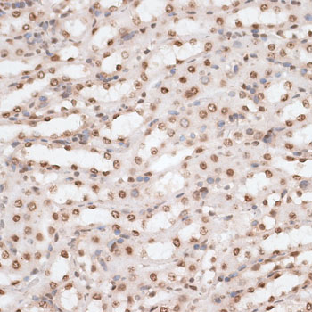 H2AFX / H2AX Antibody - Immunohistochemistry of paraffin-embedded mouse kidney using H2AFX antibody at dilution of 1:100 (40x lens).