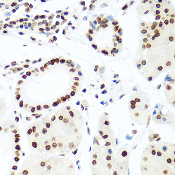 H2AFX / H2AX Antibody - Immunohistochemistry of paraffin-embedded human stomach using H2AFX antibody at dilution of 1:100 (40x lens).
