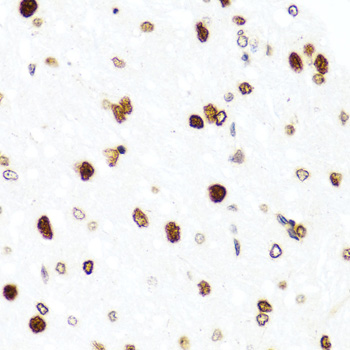 H2AFX / H2AX Antibody - Immunohistochemistry of paraffin-embedded rat brain using H2AFX antibody at dilution of 1:100 (40x lens).