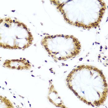 H2AFX / H2AX Antibody - Immunohistochemistry of paraffin-embedded human colon using H2AFX antibody at dilution of 1:100 (40x lens).