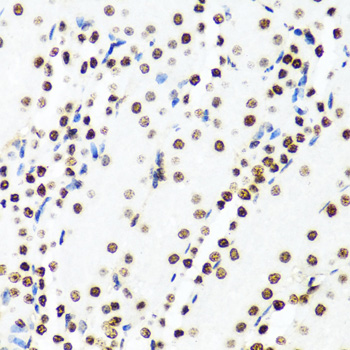 H2AFX / H2AX Antibody - Immunohistochemistry of paraffin-embedded mouse kidney using H2AFX antibody at dilution of 1:100 (40x lens).