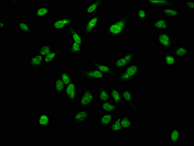 H2AFX / H2AX Antibody - Immunofluorescence staining of hela with DAPI. The cells were fixed in 4% formaldehyde, permeabilized using 0.2% Triton X-100 and blocked in 10% normal Goat Serum. The cells were then incubated with the antibody overnight at 4 °C.The secondary antibody was Alexa Fluor 488-congugated AffiniPure Goat Anti-Rabbit IgG (H+L) .
