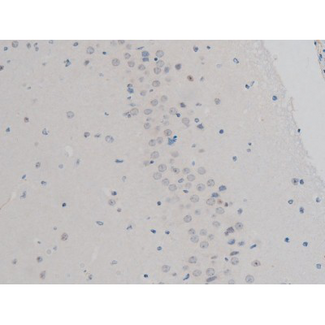 H2AFX / H2AX Antibody - 1:200 staining mouse brain tissue by IHC-P. The tissue was formaldehyde fixed and a heat mediated antigen retrieval step in citrate buffer was performed. The tissue was then blocked and incubated with the antibody for 1.5 hours at 22°C. An HRP conjugated goat anti-rabbit antibody was used as the secondary.