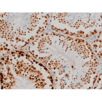H2AFX / H2AX Antibody - 1:200 staining mouse testis tissue by IHC-P. The tissue was formaldehyde fixed and a heat mediated antigen retrieval step in citrate buffer was performed. The tissue was then blocked and incubated with the antibody for 1.5 hours at 22°C. An HRP conjugated goat anti-rabbit antibody was used as the secondary.