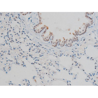 H2AFX / H2AX Antibody - 1:200 staining rat lung tissue by IHC-P. The tissue was formaldehyde fixed and a heat mediated antigen retrieval step in citrate buffer was performed. The tissue was then blocked and incubated with the antibody for 1.5 hours at 22°C. An HRP conjugated goat anti-rabbit antibody was used as the secondary.