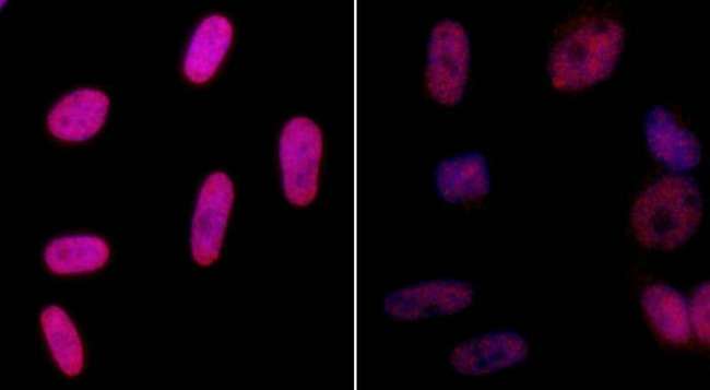H2AFX / H2AX Antibody - Detection of Human gamma-H2AX by Immunocytochemistry. Samples: Neocarzinostatin treated asynchronous HeLa cells (left) and untreated asynchronous HeLa cells (right). Antibody: Affinity purified rabbit anti-gamma-H2AX ( Lot12) used at a dilution of 1:5000 (0.2 ug/ml). Detection: Red fluorescent Anti-rabbit IgG-DyLight 594 conjugated used at a dilution of 1:100.