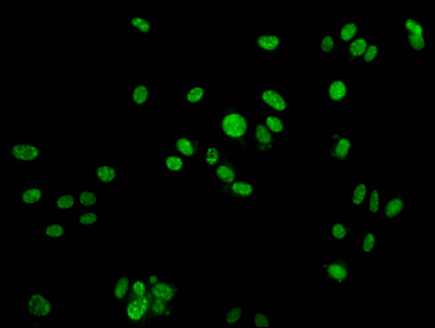 H2AFX / H2AX Antibody - Immunofluorescence staining of HepG2 cells at a dilution of 1:25, counter-stained with DAPI. The cells were fixed in 4% formaldehyde, permeabilized using 0.2% Triton X-100 and blocked in 10% normal Goat Serum. The cells were then incubated with the antibody overnight at 4 °C.The secondary antibody was Alexa Fluor 488-congugated AffiniPure Goat Anti-Rabbit IgG (H+L) .
