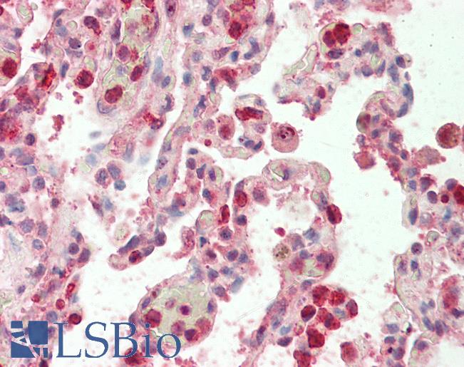 H2AFY / MACROH2A1 Antibody - Anti-H2AFY / MACROH2A1 antibody IHC staining of human lung. Immunohistochemistry of formalin-fixed, paraffin-embedded tissue after heat-induced antigen retrieval. Antibody concentration 5 ug/ml.  This image was taken for the unconjugated form of this product. Other forms have not been tested.