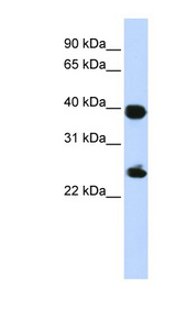 H2AFY / MACROH2A1 Antibody - H2AFY antibody Western blot of 293T cell lysate.  This image was taken for the unconjugated form of this product. Other forms have not been tested.