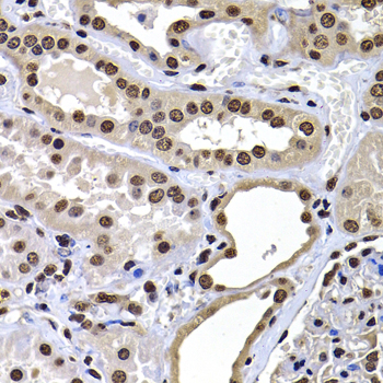 H2AFY / MACROH2A1 Antibody - Immunohistochemistry of paraffin-embedded human kidney tissue.