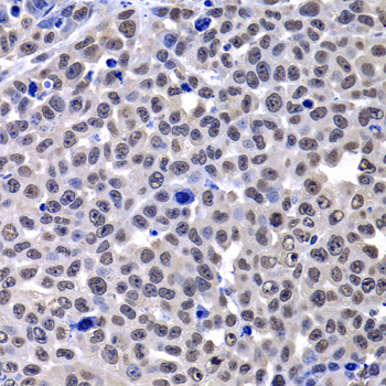 H2AFY / MACROH2A1 Antibody - Immunohistochemistry of paraffin-embedded mouse cancer tissue.