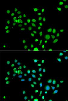 H2AFY / MACROH2A1 Antibody - Immunofluorescence analysis of U20S cells.