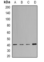 H2AFY / MACROH2A1 Antibody - Western blot analysis of MacroH2A1 expression in Jurkat (A); HeLa (B); mouse liver (C); rat lung (D) whole cell lysates.