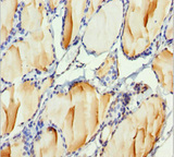 H2AFY / MACROH2A1 Antibody - Immunohistochemistry of paraffin-embedded human thyroid tissue at dilution 1:100